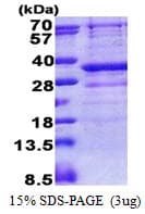 Human GIMAP5 Protein (Recombinant His)