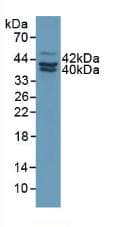 SERPINB2 / PAI-2 Antibody (aa154-408)