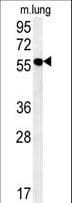ZMYND10 Antibody (aa404-429)