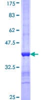 Human PROS1 / Protein S (Recombinant GST, N-terminus)