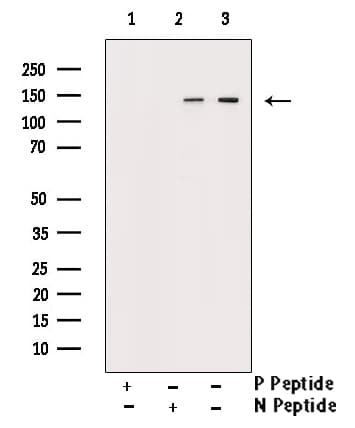 CML / BCR Antibody (phospho-Tyr360)