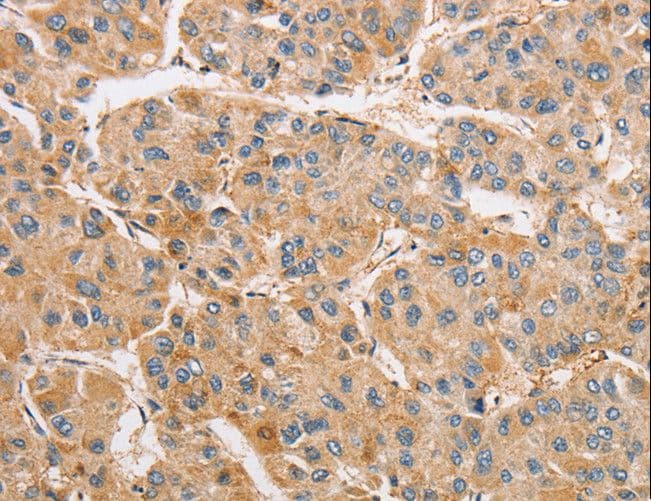 ARMCX1 Antibody