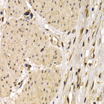 Polyclonal Rabbit anti-Human CD40 Antibody (IHC, WB)