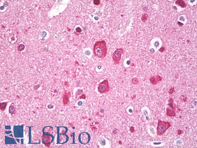IHC-plus™ MAP1LC3A / LC3A Antibody (aa1-50)