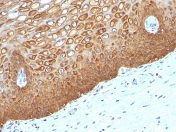 KRT14 / CK14 / Cytokeratin 14 Antibody (clone KRT14/532, Ready-to-Use)