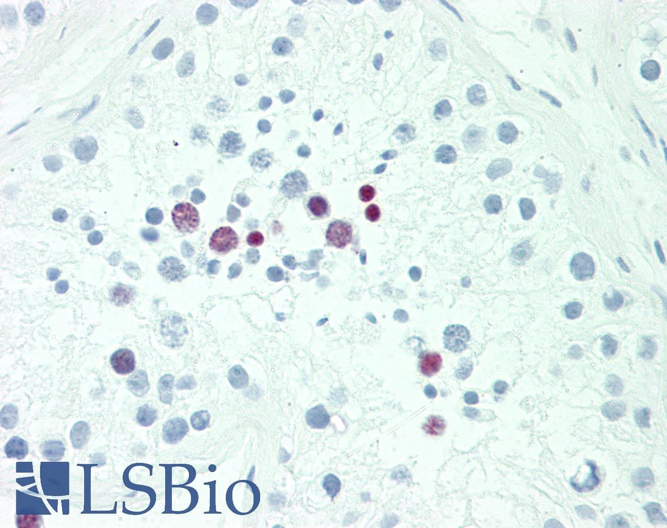 IHC-plus™ POU5F1B Antibody (aa214-242)