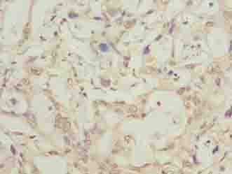 Polyclonal Rabbit anti-Human LRTM1 Antibody (IHC, WB)