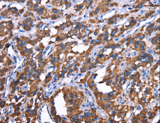 Polyclonal Rabbit anti-Human GREB1 Antibody (IHC)