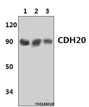 CDH20 / Cadherin 20 Antibody