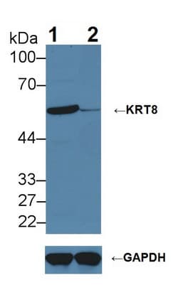 Polyclonal Rabbit anti-Human KRT8 / CK8 / Cytokeratin 8 Antibody (aa92-393, WB)