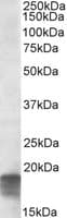 IHC-plus™ SDHAF1 Antibody (aa102-115)