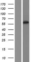 CYP2C19 Protein (Over-Expression Lysate Myc-DDK (Flag))