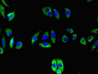 TRAIL-R3 / DCR1 Antibody