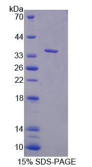 Mouse CASC1 Protein (Recombinant His, N-Terminal)