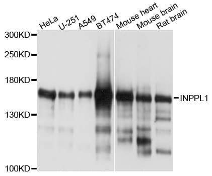 INPPL1 / SHIP2 Antibody