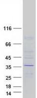 Human WDR61 Protein (Recombinant Myc-DDK (Flag))