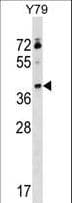 Polyclonal Rabbit anti-Human KLHDC8B Antibody (aa245-273, WB)