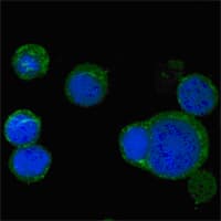 IHC-plus™ WNT5A Antibody (clone 6F2)
