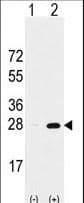 Polyclonal Rabbit anti-Human PSMA5 Antibody (aa106-135, IHC, WB)