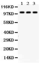 NAK / TBK1 Antibody (aa577-590)