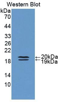 FABP9 / Lipid-Binding Protein Antibody (aa1-130)