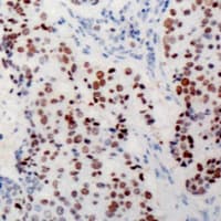 MYC / c-Myc Antibody (C-Terminus)