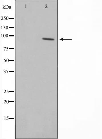 Polyclonal Rabbit anti-Human SENP5 Antibody (IHC, IF, WB)