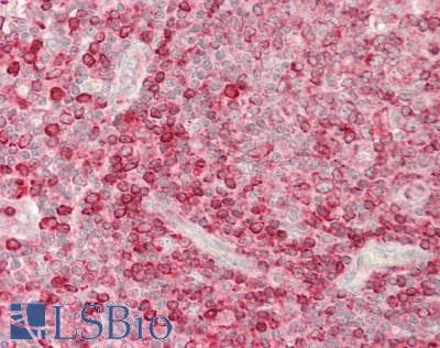 IHC-plus™ CEP120 Antibody