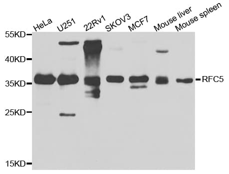 RFC5 Antibody