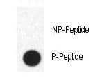 FABP4 / AP2 Antibody (phospho-Tyr20)