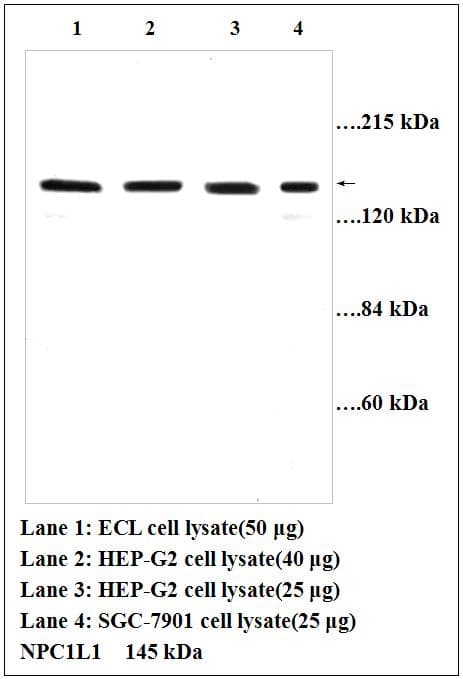Polyclonal Rabbit anti-Human NPC1L1 Antibody (aa596-610, WB)