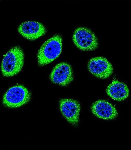 GCLC Antibody (aa1-30)