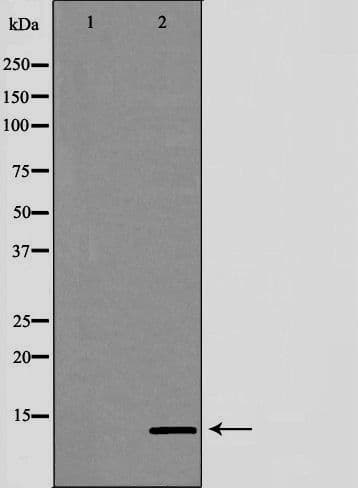 SNCG / Gamma-Synuclein Antibody