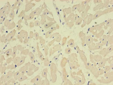 NPPB / BNP Antibody (aa27-102)