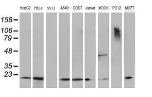DSTN / Destrin Antibody (clone OTI1G8, Carrier-free)
