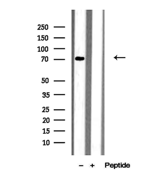 MEPCE Antibody