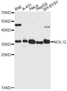 Polyclonal Rabbit anti-Human NOL12 Antibody (WB)