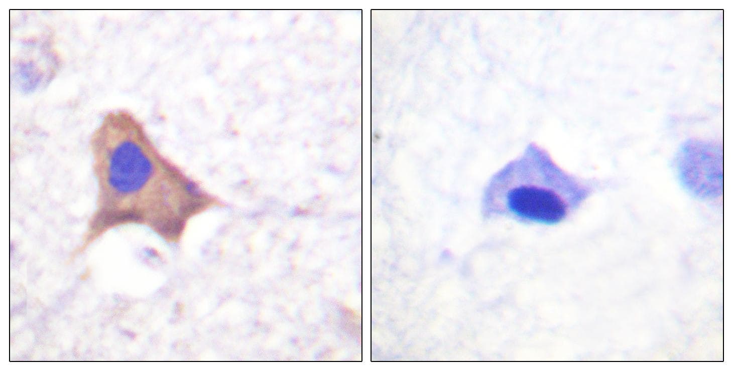 Polyclonal Rabbit anti-Human CD71 / Transferrin Receptor Antibody (phospho-Ser24, IHC, WB)