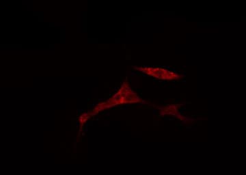 Polyclonal Rabbit anti-Human CDCA2 Antibody (IF, WB)
