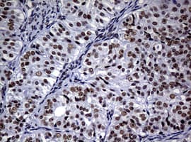 NBN / Nibrin Antibody (aa183-460, clone OTI3C12, Carrier-free)