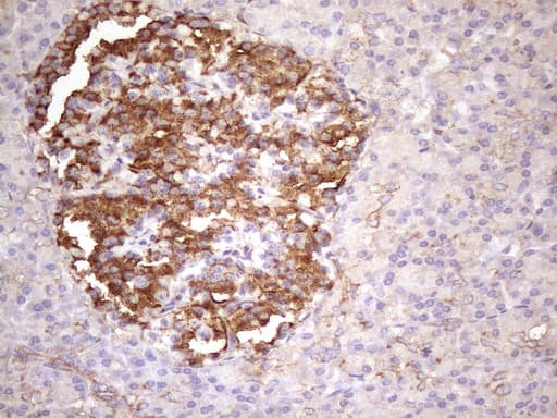 p16INK4a / CDKN2A Antibody (clone OTI2G1)