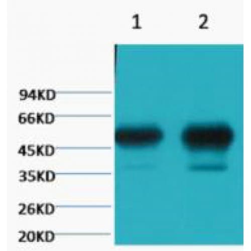 Tubulin Beta 2 Antibody (clone Mix)