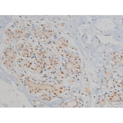 MAPK3 / ERK1 Antibody (phospho-Tyr204,pThr202)