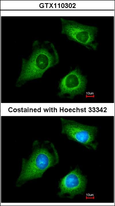 IHC-plus™ FKTN / Fukutin Antibody
