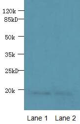 PDE6D / PDE6 Delta Antibody