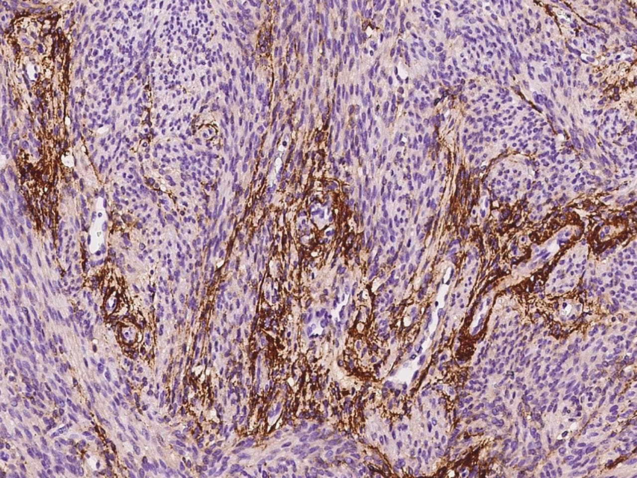 Polyclonal Rabbit anti-Human MFAP4 Antibody (IHC)