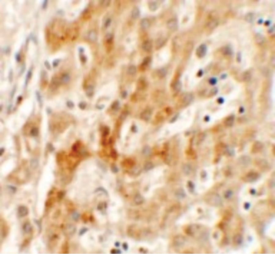 TMEM106B Antibody