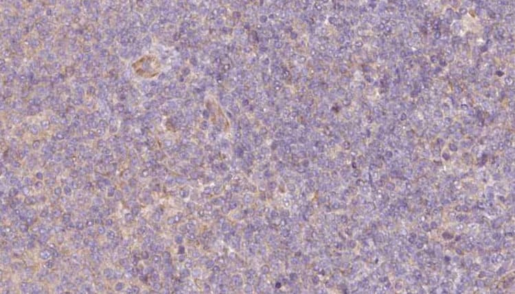 Polyclonal Rabbit anti-Human DESI2 / PPPDE1 Antibody (IHC, WB)