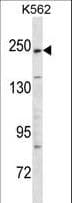 Polyclonal Rabbit anti-Human KIDINS220 / ARMS Antibody (aa1518-1547, WB)