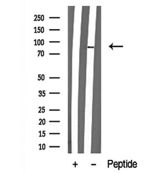 RPS6KA4 / MSK2 / RSK-B Antibody